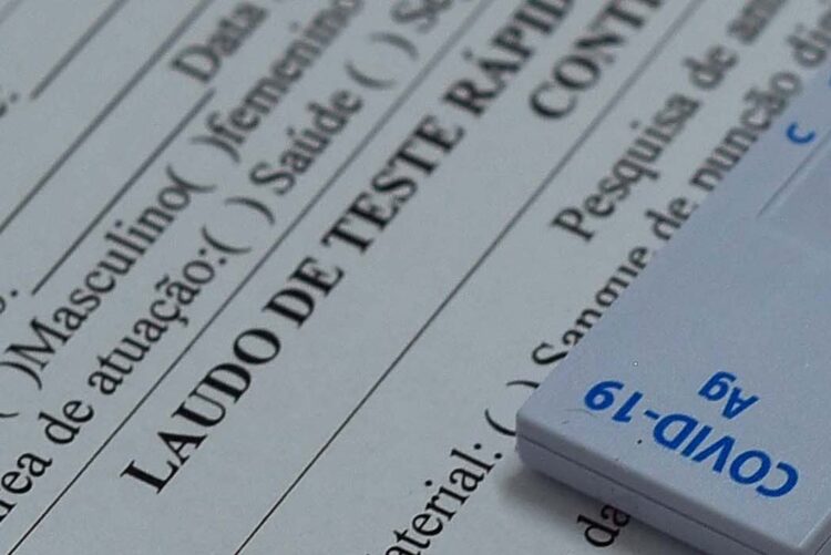 Covid-19: Paranavaí tem 155 pessoas com o vírus ativo