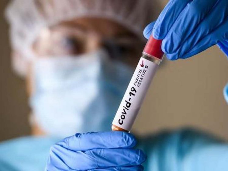 Saúde divulga mais 11.384 casos confirmados e 17 óbitos por Covid-19