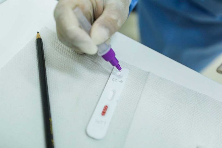 Brasil registra queda na média móvel de casos de Covid pelo segundo dia consecutivo