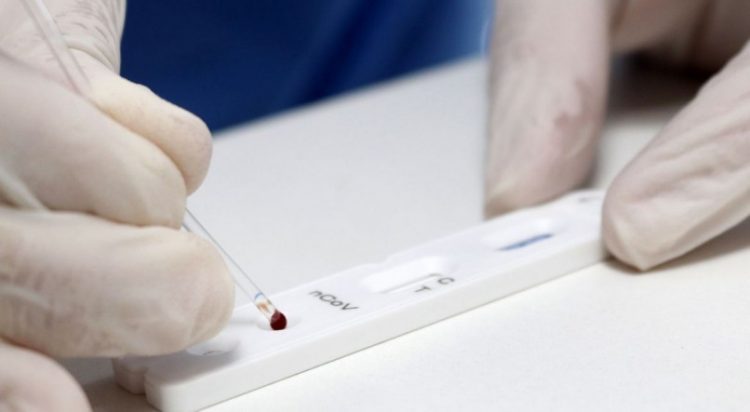 Pesquisadores apontam por que a Covid é mais grave em pessoas com síndrome de Down