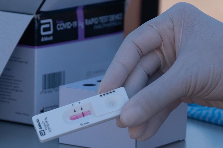 Saúde confirma 65 novos casos de Covid-19 em Paranavaí