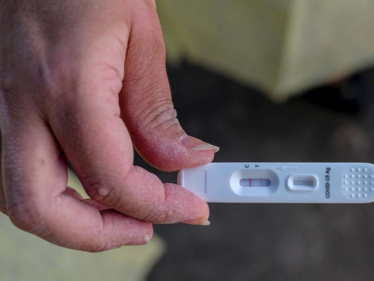 Índice de positivos em teste de Covid de farmácia é o maior em 17 semanas