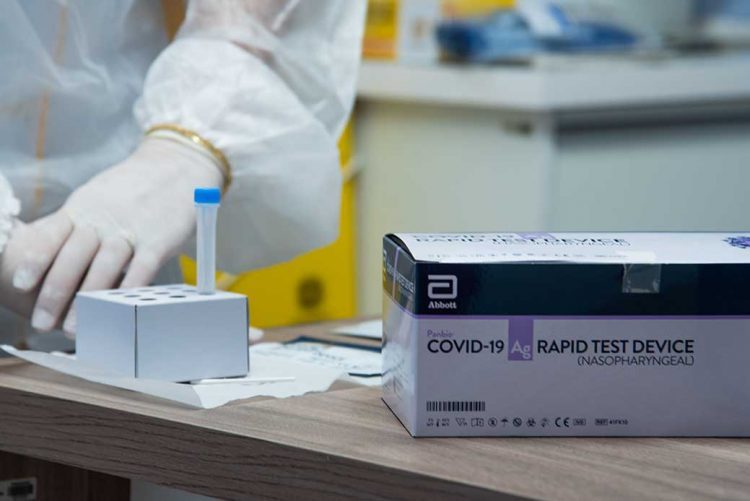 Farmácias registram 1ª queda nos casos de Covid em 7 semanas