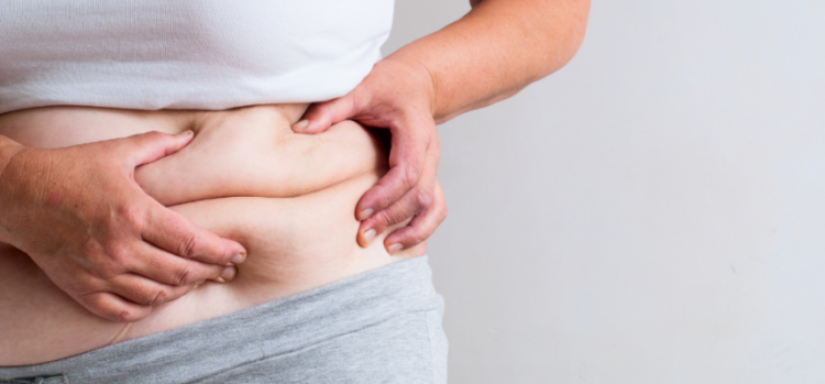 Estão abertas as inscrições para o programa  de tratamento de obesidade em Paranavaí