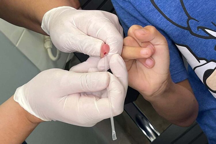 Estado reforça atenção para diagnóstico  da hanseníase e luta contra o preconceito