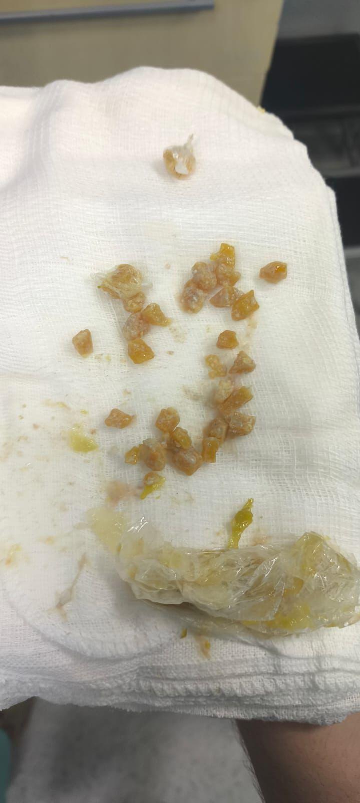 Mulher é presa após ingerir e esconder pedras de crack nas partes íntimas em Paranavaí